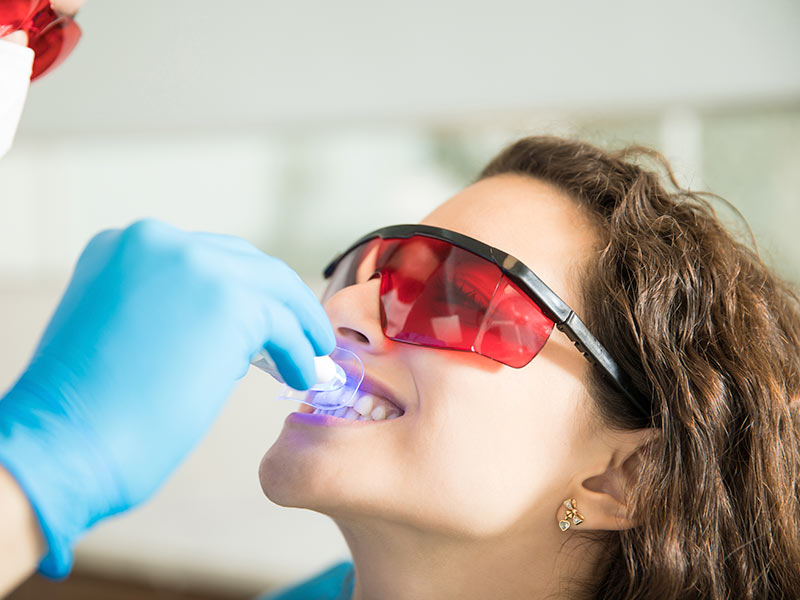clareamento dental