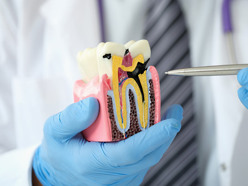 endodontia