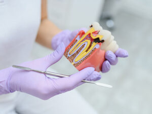 endodontia