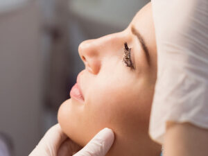 harmonização facial