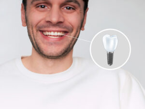 implantes dentários