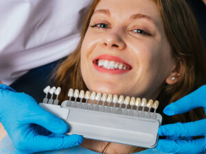 lentes de contato dental